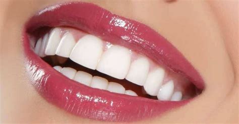 Men Hollywood Smile Dental