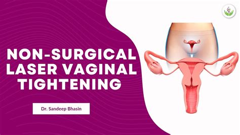 Non Surgical Laser Vaginal Tightening Rejuvenation Treatment Care