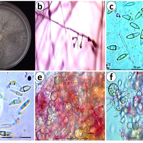 Morphological Characters Of Fusarium Falciforme A Colony Characters