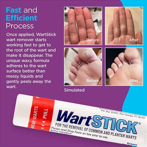 wartstick maximum strength salicylic acid solid stick common and plantar wart remover 0 2 oz