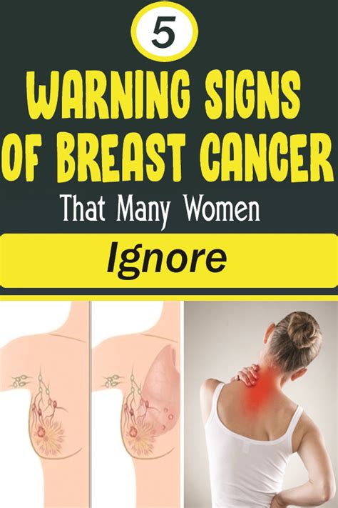 5 warning signs of breast cancer that many women ignore