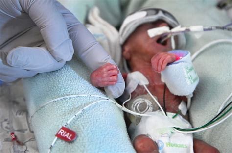 Premature Births At An All Time High In The Us March Of Dimes Report