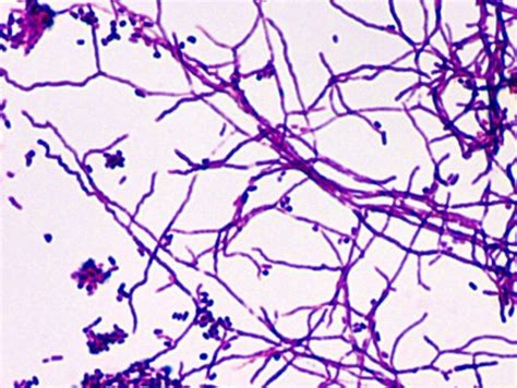 ¿las Bacterias Acidorresistentes Son Grampositivas O Gramnegativas