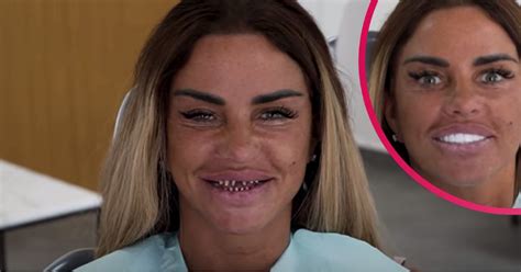 Katie Price Horrifies Fans With New Veneers Entertainment Daily