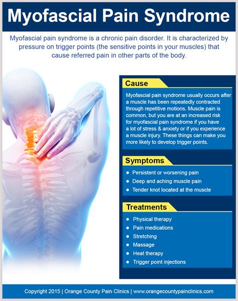 Myofascial Pain Syndrome Orange County Pain Clinics