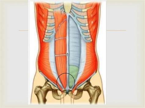 AnatomÍa De La Pared Abdominal Ppt