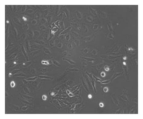 Microscopic Images Of Different Stages Of HeLa Cell Proliferation A Download Scientific