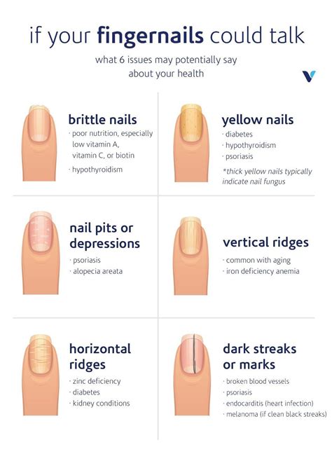 what your fingernails say about your health what s good by v fingernail health nail health