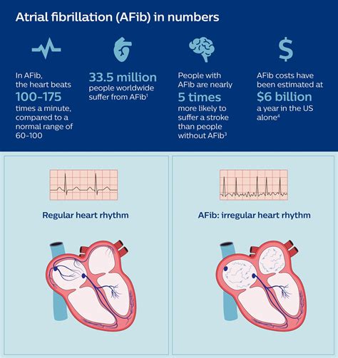 How A New Way Of Visualizing The Heart Can Help Fight Atrial