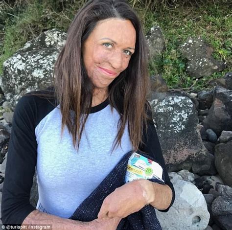 Pregnant Burns Survivor Turia Pitt Shares Video Recovery Daily Mail Online