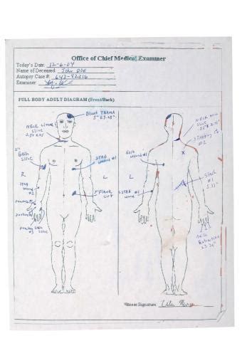 Autopsy Body Chart