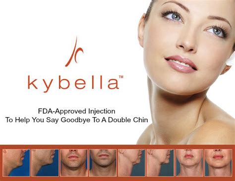 Kybella Chin Fat Removal In San Diego Non Surgical Solution