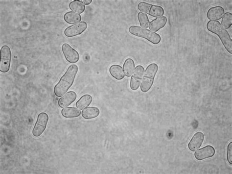 Yeast Cell Under Light Microscope Micropedia