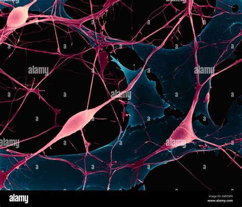 Las Neuronas Piramidales Corticales Del Sistema Nervioso Central Crecen