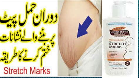 How To Remove Stretch Marks Palmers Massage Lotion For Stretch Marks