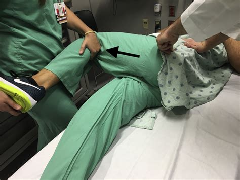 Hip Dislocations In The Emergency Department A Review Of Reduction