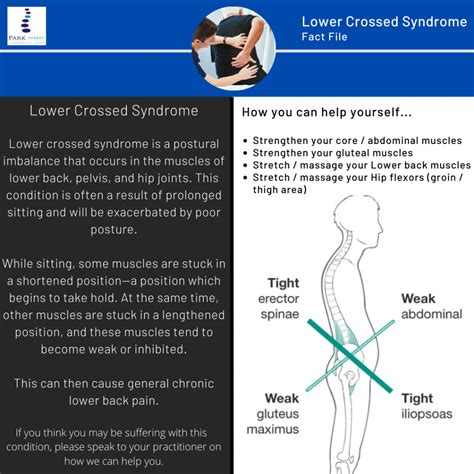Lower Crossed Syndrome Park Street Chiropractic Leamington Spa