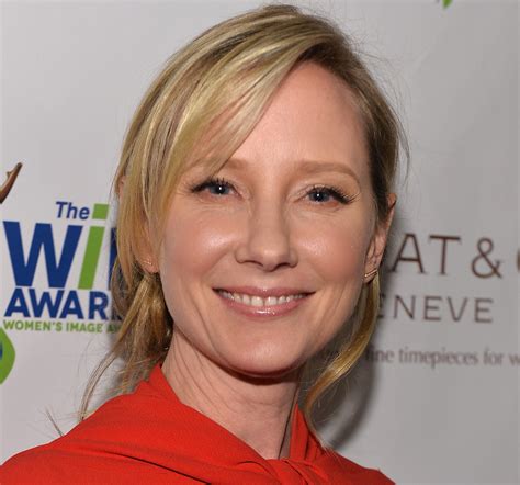 Anne Heche Was Declared Brain Dead How Does It Affect The Body Npr