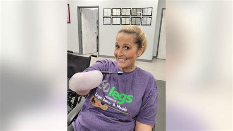 Ohio Woman Who Lost All Four Limbs To Flu Complications Speaks Out To