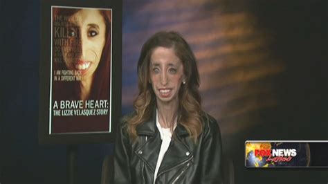 Lizzie Velasquez Once ‘worlds Ugliest Woman Now Among The Bravest Fox News