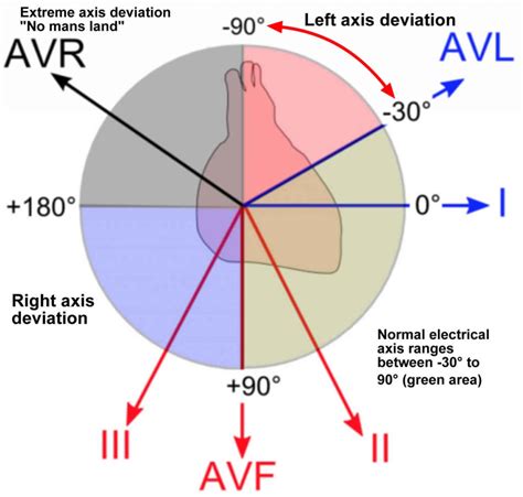 Heart Left Axis Deviation Causes Symptoms And Treatment
