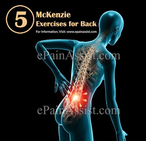 5 Mckenzie Exercises For Back