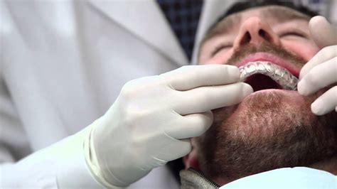 Why An Orthodontist Your Orthodontist Dr Kenneth Cohen Sasson Tamarac Fl Youtube