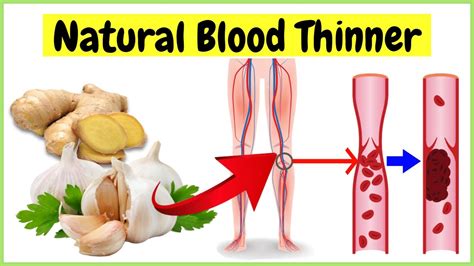 8 Natural Blood Thinners That Prevent Blood Clots Youtube
