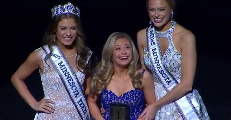 Contestant With Down Syndrome Shines While Making Miss Usa Pageant