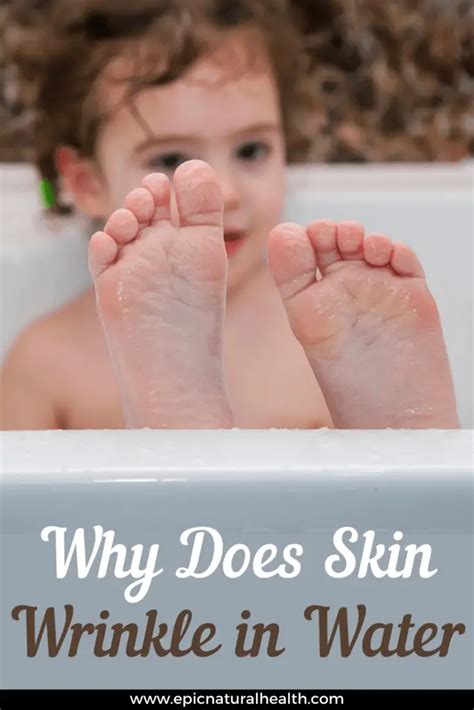 Why Does Your Skin Fingers Hands Feet Wrinkle Or Get Pruney In Water Epic Natural Health