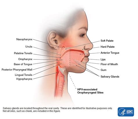 Head And Neck Cancers Cdc