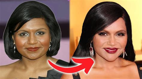 Mindy Kaling S New Look Ozempic And Plastic Surgeries Youtube
