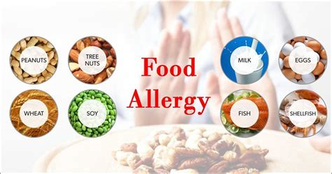 8 Common Food Allergies Causes Symptoms And Treatment