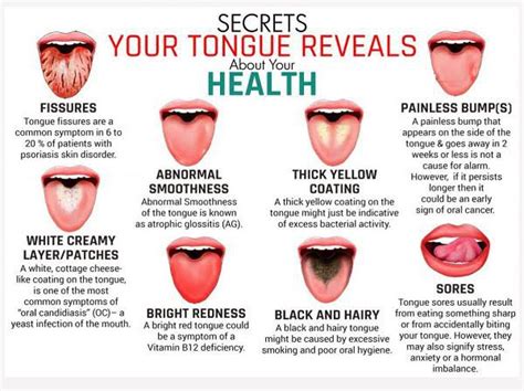 Is It Normal To Have A Coating On Your Tongue Quora