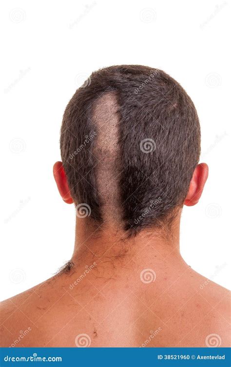 Back Of Man Head While His Hair Is Cut Stock Photo Image 38521960