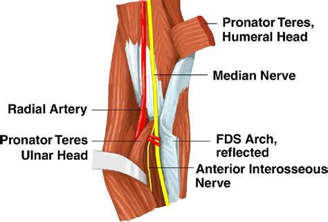 Unusual Compression Neuropathies of the Forearm, Part II: Median Nerve