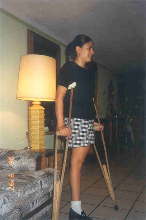 Девушки на костылях Amputee Woman On Crutches Page 15 Amputee