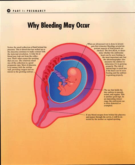 first trimester bleeding image 1