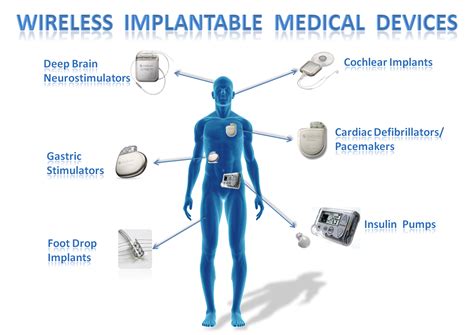 Wireless Implantable Medical Devices Links To Examples