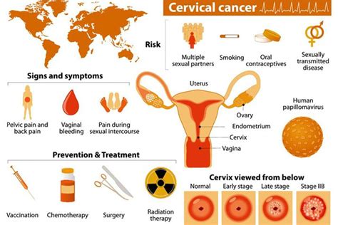 Cervical Cancer A Forgotten Tragedy