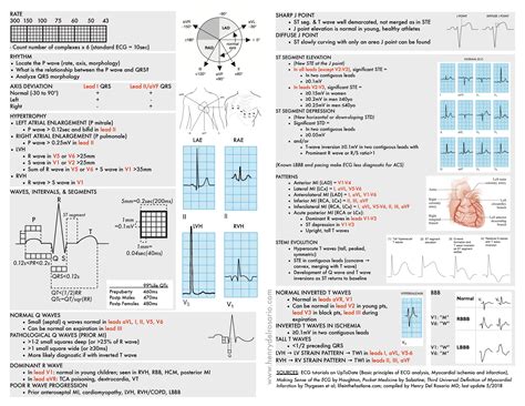 Ecg Cheat Sheet Ecg Rapid View It Is Organized Grepmed