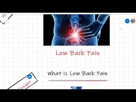 Mechanical Back Pain Low Back Pain Lbp Youtube