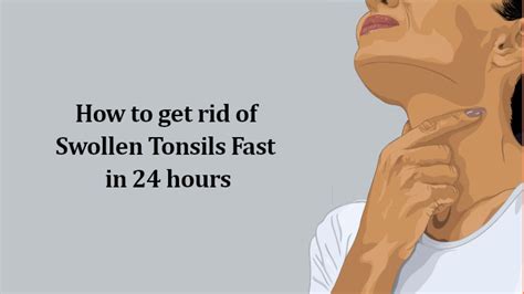 How To Get Rid Of Swollen Tonsils Fast In 24 Hours 2022