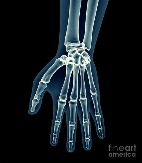 X Ray Human Body Of A Man With Skeleton Digital Art By Posteriori Pixels