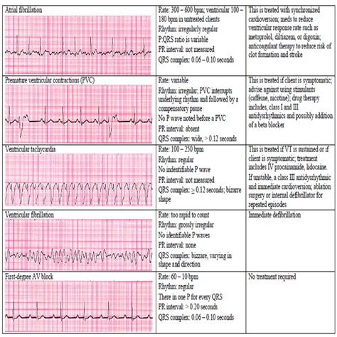 Full Cardiology Nursing Study Guide Review With BONUS File 13 Sinus