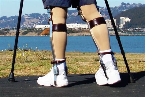 Pin By John Beeson On Leg Braces In 2021 Ballet Shoes Sport Shoes