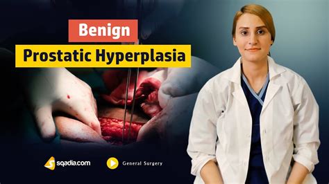 Benign Prostatic Hyperplasia Surgery Lectures Medical Online V Learning Sqadia Com Youtube