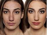 Images of How To Cover Up Dark Spots With Makeup