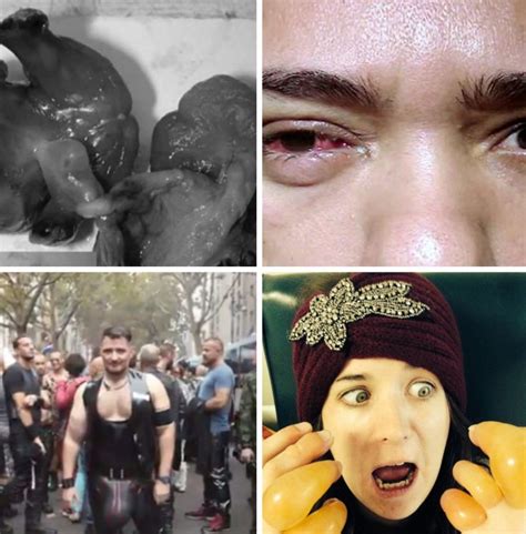 Weird Science 8 Most Bizarre Medical Anomalies Of 2015
