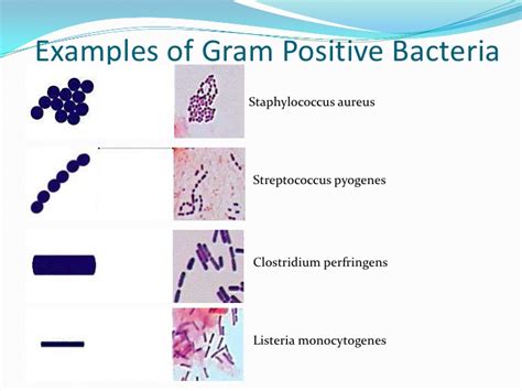 All staphylococci produce catalase, whereas no streptococci do. Bacterial characteristics - Gram staining (video) | Khan ...